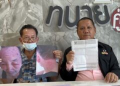 นนทบุรี I ลุงวัย 83 ปี โร่ร้องทนายดังหลังใช้ยาย้อมผมยี่ห้อดัง แต่เกิดอาการแพ้ปวดแสบปวดร้อนเป็นผื่นน้ำเหลืองไหลทั้งศรีษะ