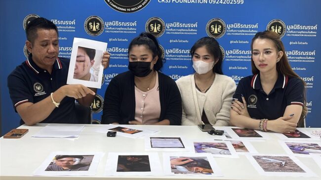 นนทบุรี : พี่สาวร้องทนายรณรงค์ น้องชายถูกคู่กรณีฟันจนหน้าเสียโฉม ตำรวจกับแจ้งข้อหาทำร้ายร่างกายกันทั้งสองฝ่าย